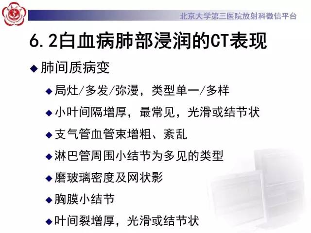 【病例】白血病肺部纵隔浸润1例CT影像表现