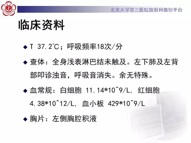 【病例】白血病肺部纵隔浸润1例CT影像表现