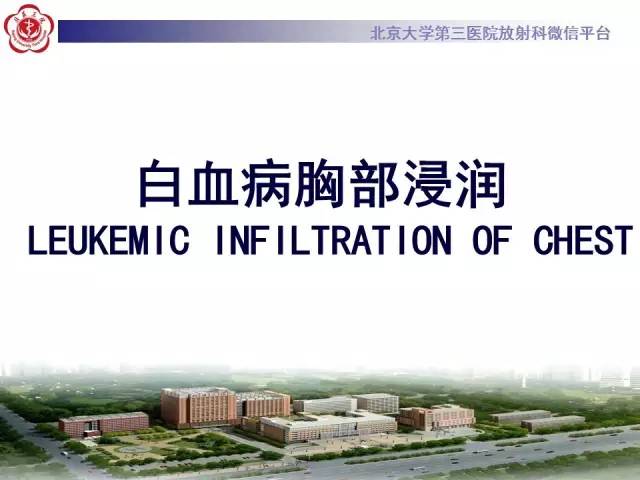 【病例】白血病肺部纵隔浸润1例CT影像表现