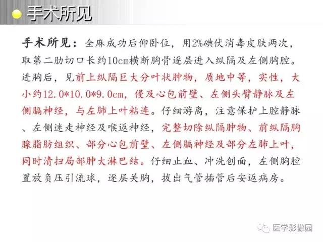 【病例】纵隔胸腺神经内分泌癌1例CT影像分析