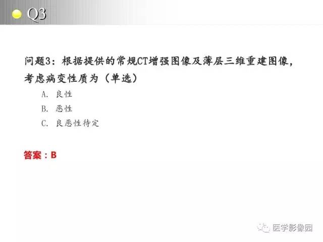 【病例】纵隔胸腺神经内分泌癌1例CT影像分析
