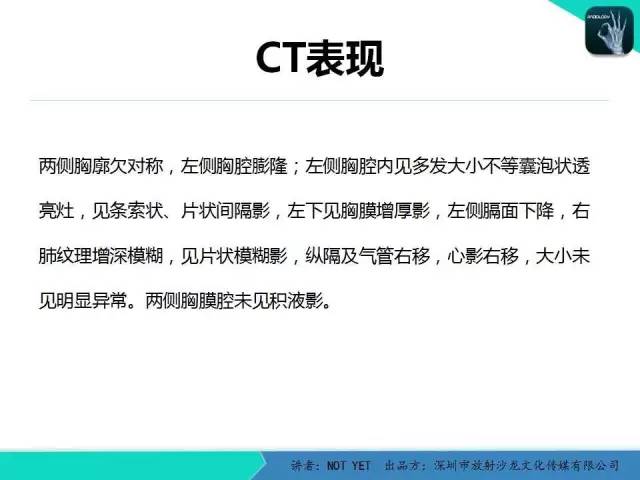 【病例】肺先天性囊性腺瘤样畸形1例CT