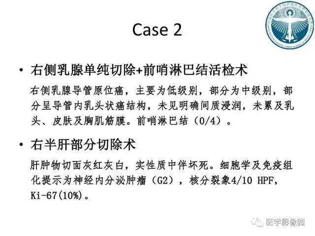 【病例】乳腺癌+肝脏神经内分泌肿瘤1例CT及MR