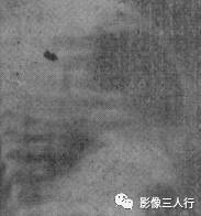 “横膈连续征” 的影像表现与临床意义