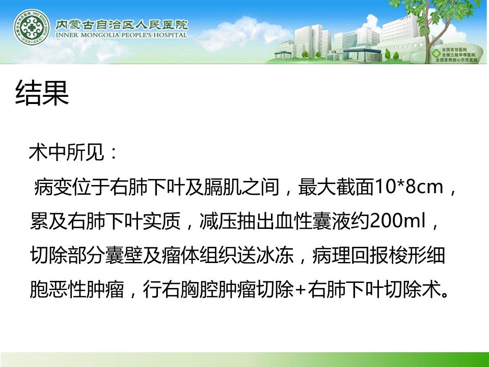 【病例】胸膜恶性孤立性纤维瘤1例X线CT