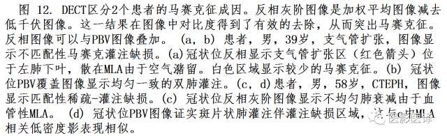 肺动脉高压的双能CT影像：挑战与机遇