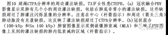 肺动脉高压的双能CT影像：挑战与机遇