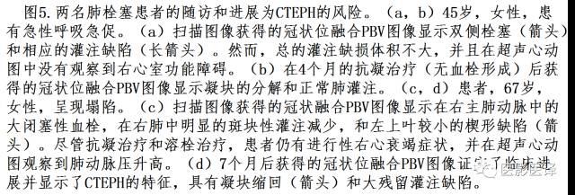 肺动脉高压的双能CT影像：挑战与机遇