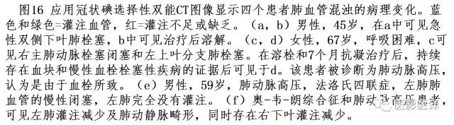 肺动脉高压的双能CT影像：挑战与机遇