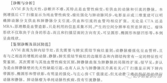 【病例】肺动静脉畸形1例CT影像表现