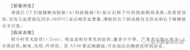 【病例】肺动静脉畸形1例CT影像表现