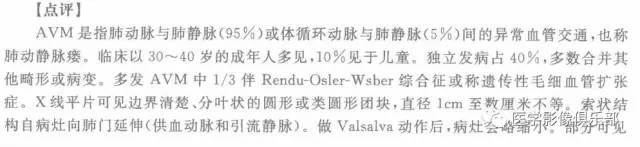 【病例】肺动静脉畸形1例CT影像表现