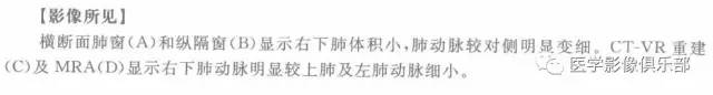 【病例】右下肺动脉发育不良1例CT影像表现