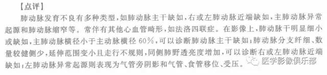 【病例】右下肺动脉发育不良1例CT影像表现