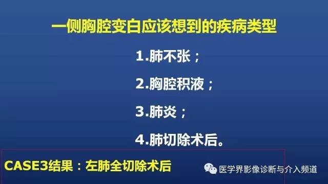 【PPT】胸部疾病鉴别诊断精要