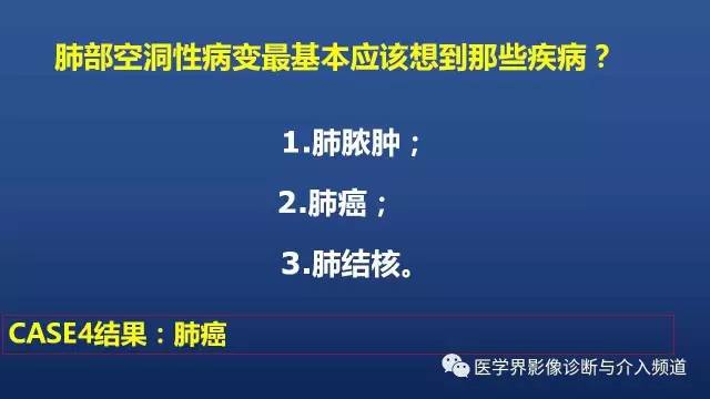 【PPT】胸部疾病鉴别诊断精要