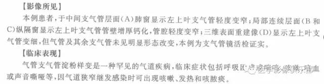 【病例】气管支气管淀粉样变性1例CT影像表现