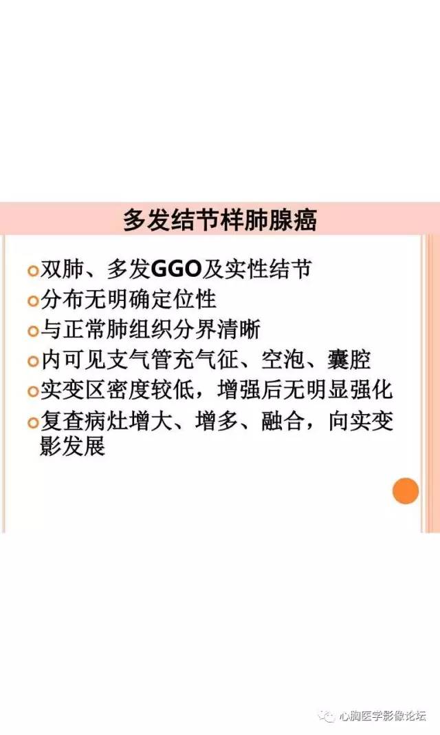【病例】肺淋巴瘤样肉芽肿LYG一例CT影像诊断与鉴别