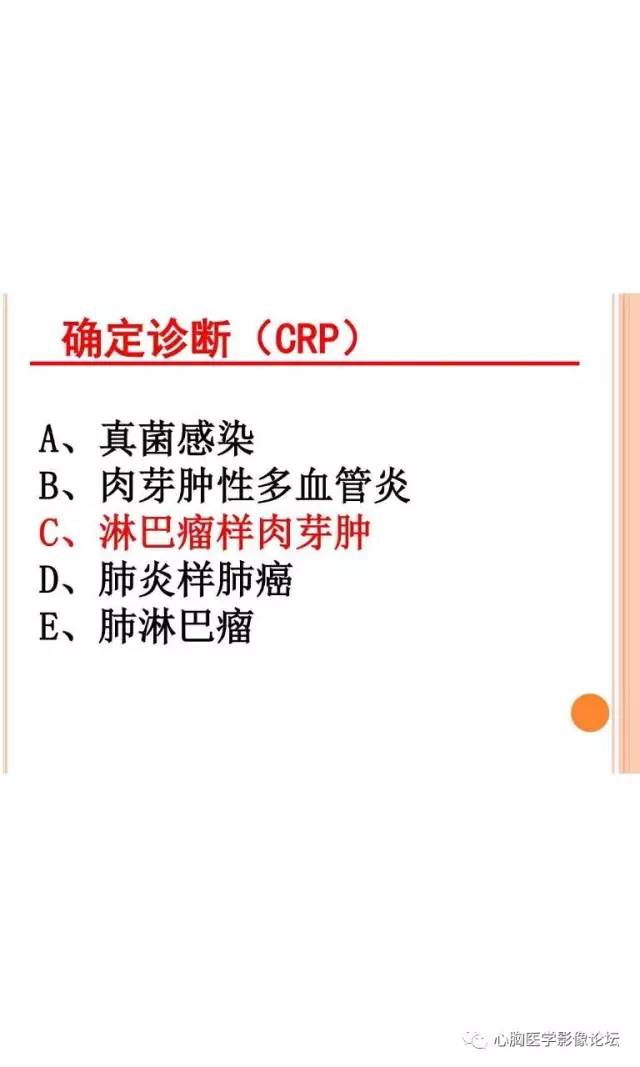 【病例】肺淋巴瘤样肉芽肿LYG一例CT影像诊断与鉴别