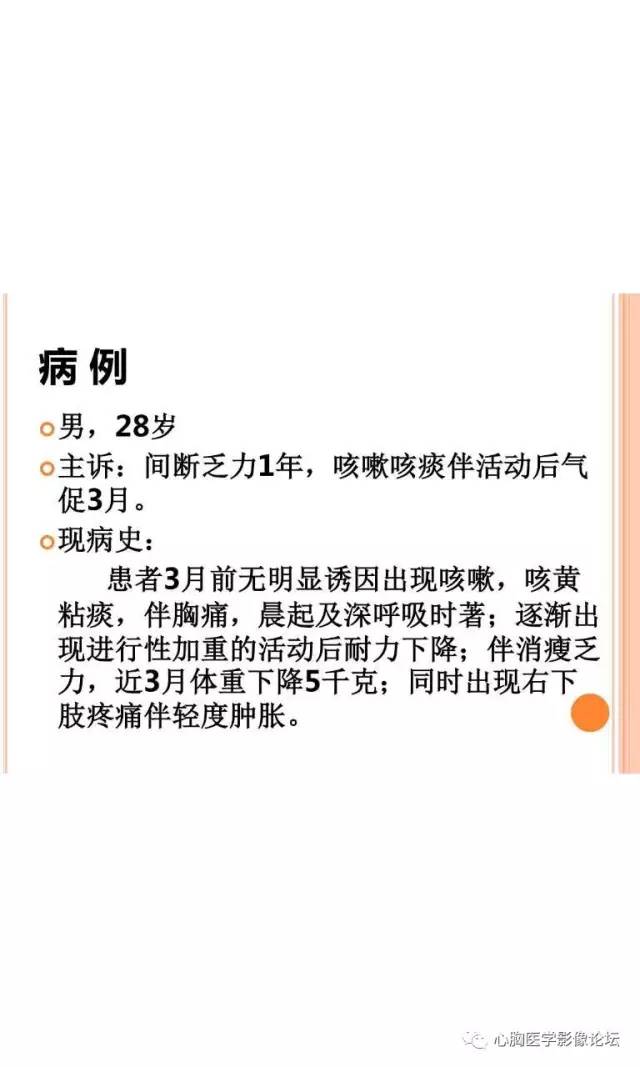 【病例】肺淋巴瘤样肉芽肿LYG一例CT影像诊断与鉴别