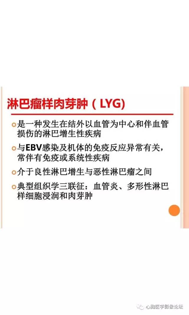 【病例】肺淋巴瘤样肉芽肿LYG一例CT影像诊断与鉴别