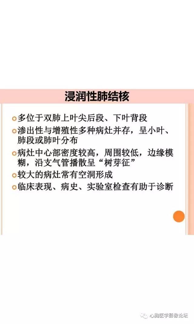 【病例】肺淋巴瘤样肉芽肿LYG一例CT影像诊断与鉴别