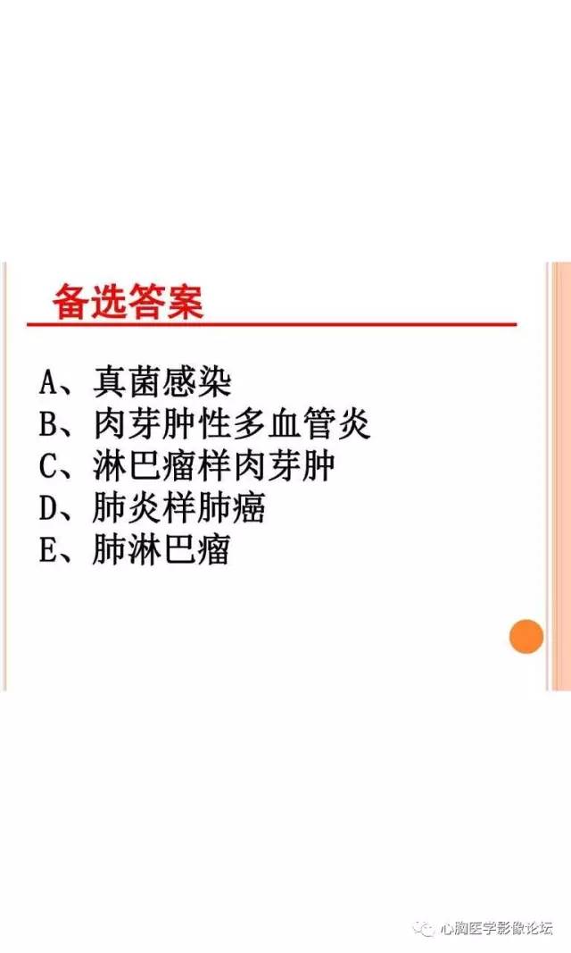 【病例】肺淋巴瘤样肉芽肿LYG一例CT影像诊断与鉴别