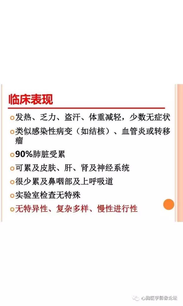 【病例】肺淋巴瘤样肉芽肿LYG一例CT影像诊断与鉴别