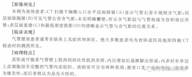 【病例】气管憩室1例CT影像表现