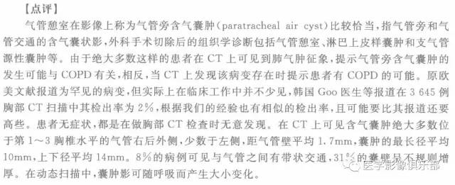 【病例】气管憩室1例CT影像表现