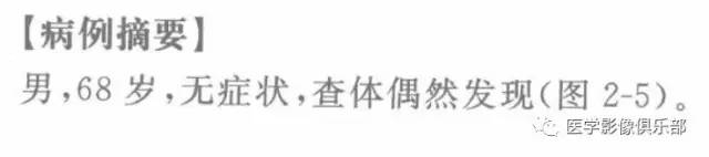 【病例】气管憩室1例CT影像表现