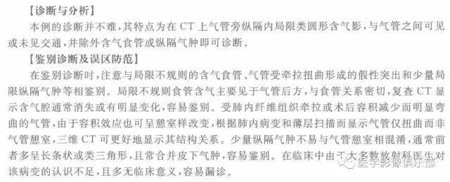 【病例】气管憩室1例CT影像表现