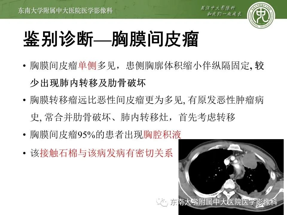 【PPT】干性胸膜转移