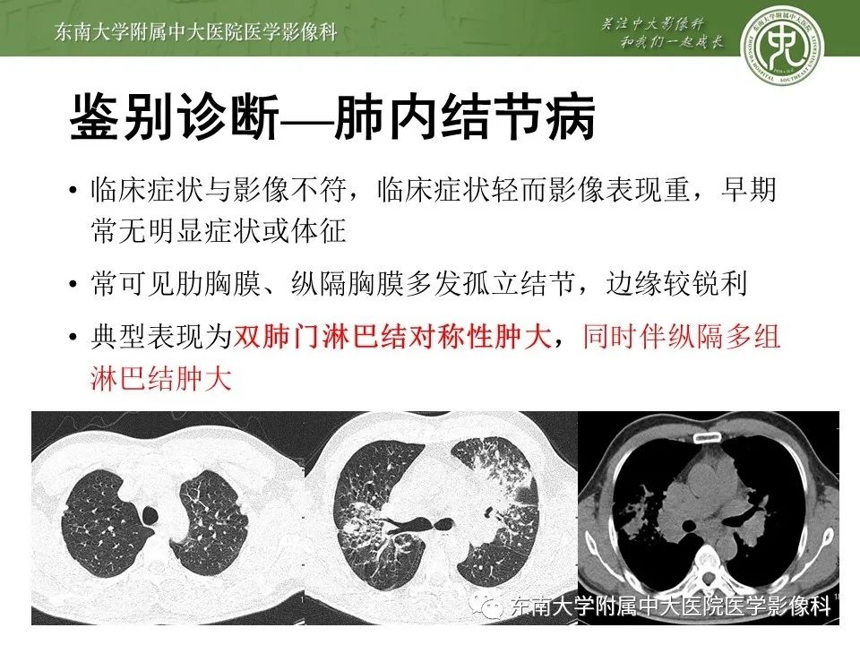 【PPT】干性胸膜转移