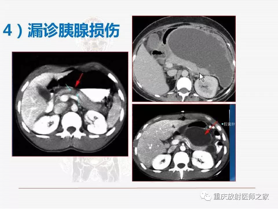 【PPT】
