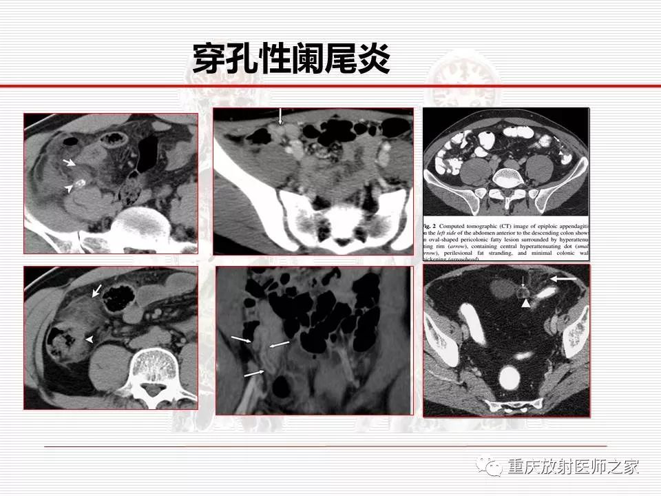 【PPT】