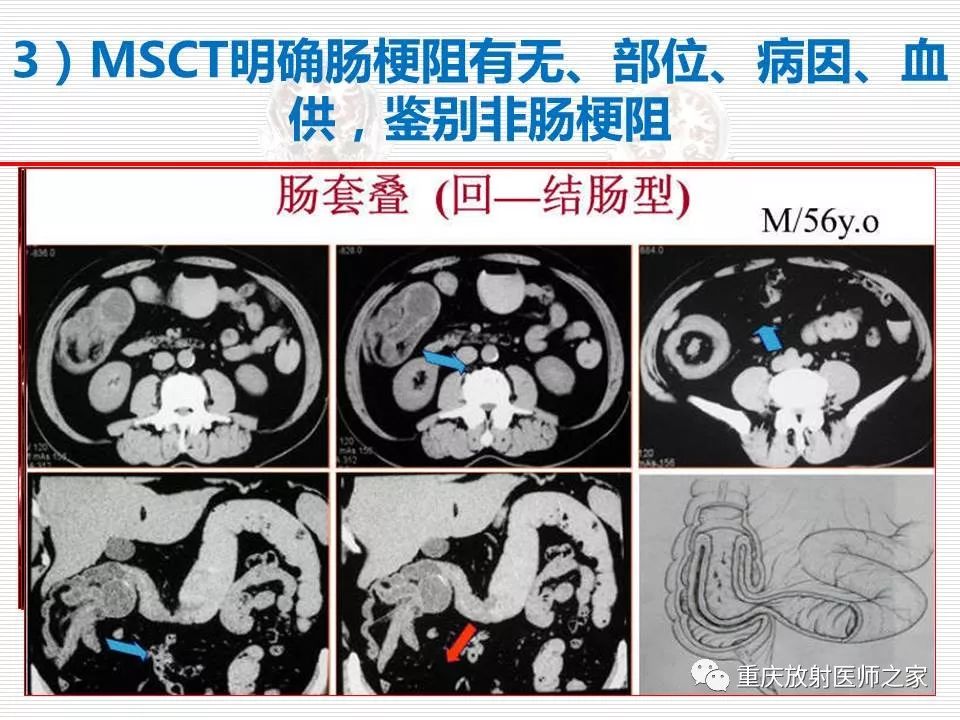 【PPT】