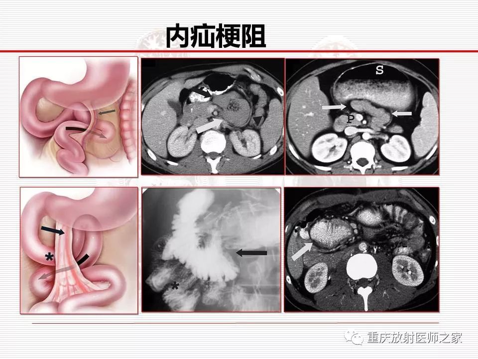 【PPT】
