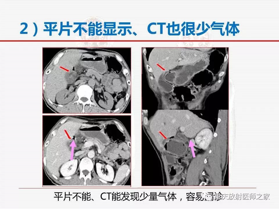 【PPT】