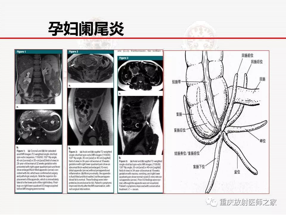 【PPT】