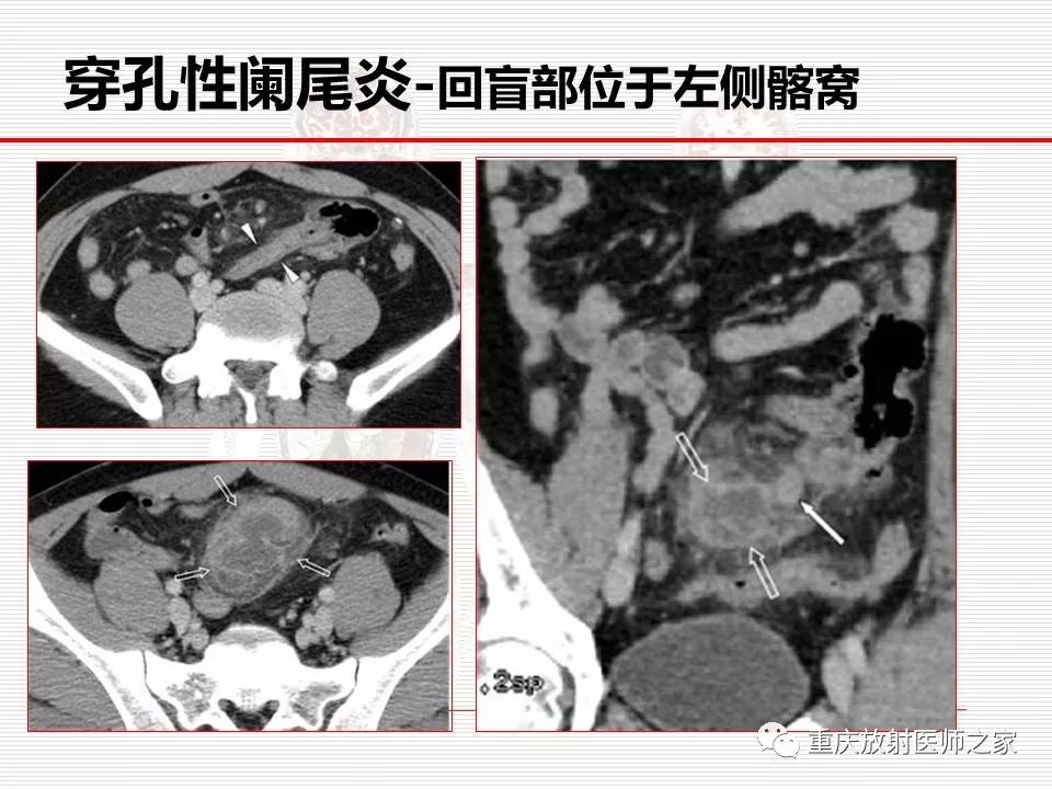 【PPT】