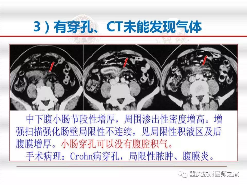 【PPT】