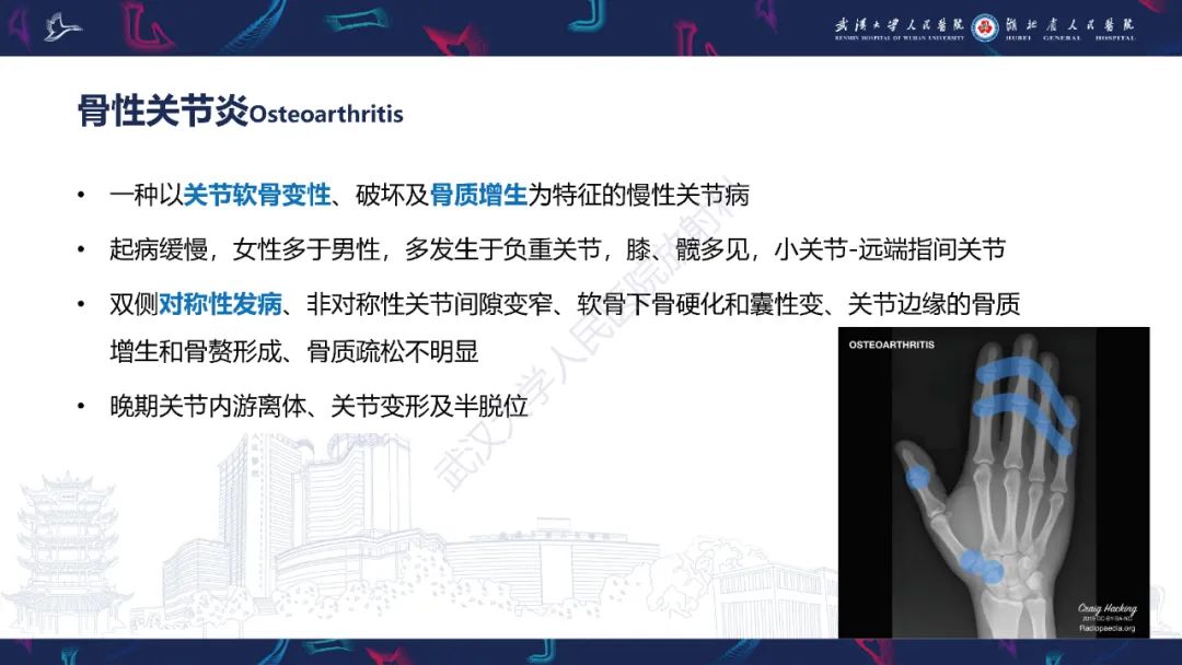 【PPT】关节痛风影像诊断