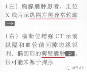 “纵隔囊性肿块”的鉴别诊断