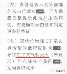 “纵隔囊性肿块”的鉴别诊断
