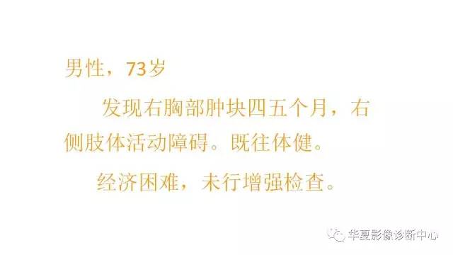【病例】右肺原始神经外胚层肿瘤PNET一例CT