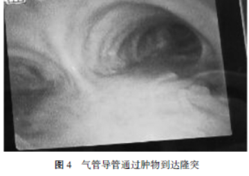 1594165033399282.png