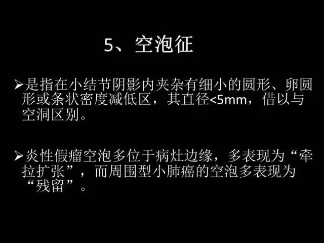 【PPT】肺内孤立性小结节的CT诊断探析