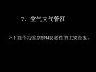 肺内孤立性小结节的CT诊断探析