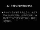 肺内孤立性小结节的CT诊断探析